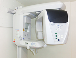 デジタルレントゲン画像